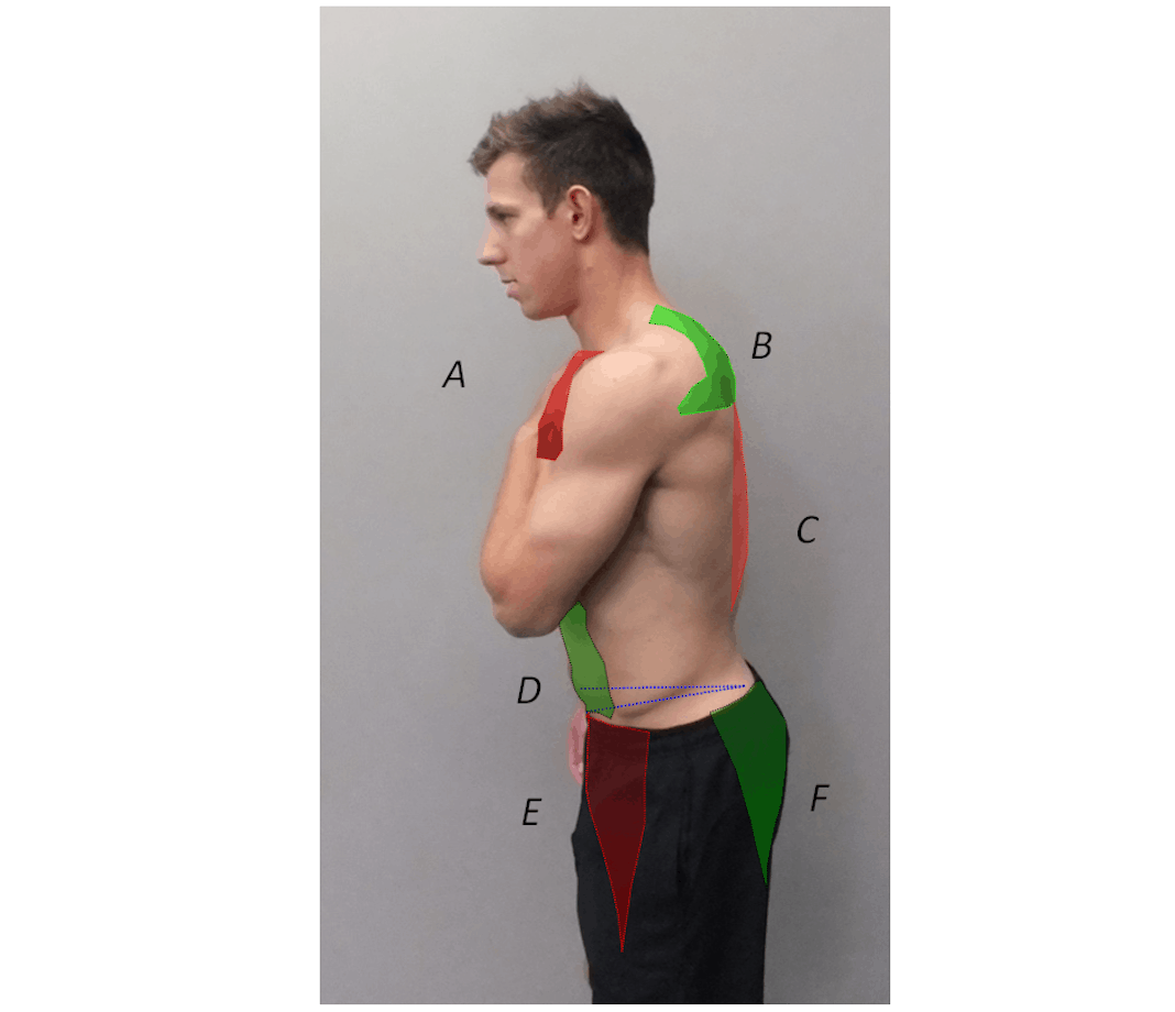 Man's profile with green tape on stomach and shoulder blades, and red tape on chest and middle back.