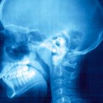 7 Common Paddling Injuries And How To Prevent Them X-ray External otitis (swimmer’s ear)