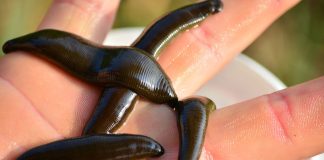 leeches on the palm of a person's hand