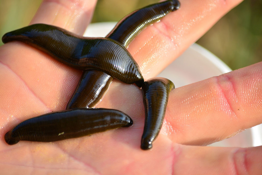 leeches on the palm of a person's hand