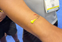 A hook embedded in @charliehookem's arm.