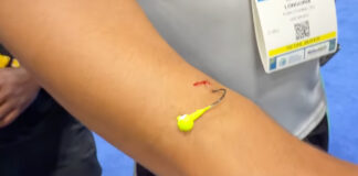 A hook embedded in @charliehookem's arm.